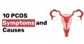 10 PCOS Symptoms and Causes