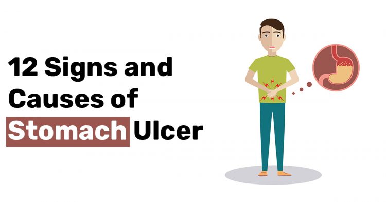 12 Signs and Causes of Stomach Ulcer