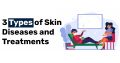 3 Types of Skin Diseases and Treatments