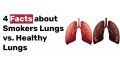 4 Facts about Smokers Lungs vs. Healthy Lungs
