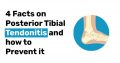 4 Facts on Posterior Tibial Tendonitis and How to Prevent it