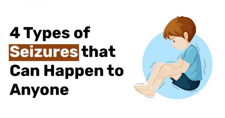 4 Types of Seizures that Can Happen to Anyone