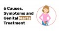 6 Causes Symptoms and Genital Warts Treatment
