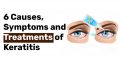 6 Causes Symptoms and Treatments of Keratitis