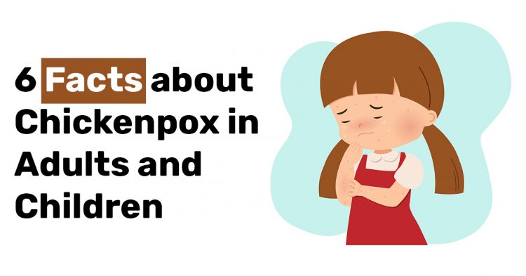 6 Facts about Chickenpox in Adults and Children