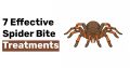 7 Effective Spider Bite Treatments