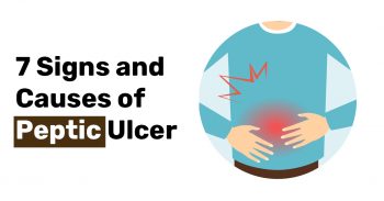 7 Signs and Causes of Peptic Ulcer