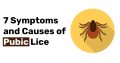 7 Symptoms and Causes of Pubic Lice