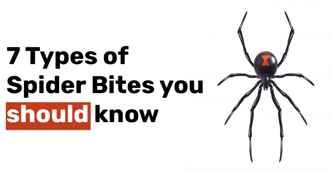 7 Types of Spider Bites you should know
