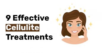 9 Effective Cellulite Treatments