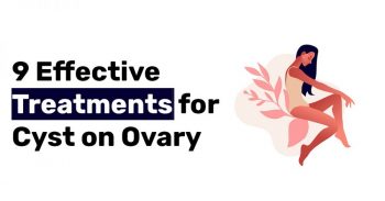 9 Effective Treatments for Cyst on Ovary