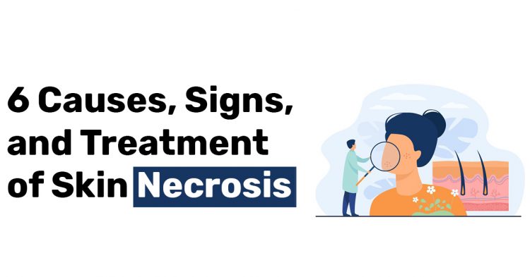 6 Causes Signs and Treatment of Skin Necrosis