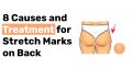 8 Causes and Treatment for Stretch Marks on Back