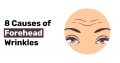 8 Causes of Forehead Wrinkles