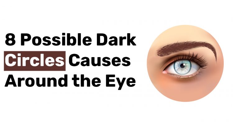 8 Possible Dark Circles Causes Around the Eye