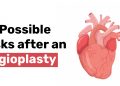 10 Possible Risks after an Angioplasty