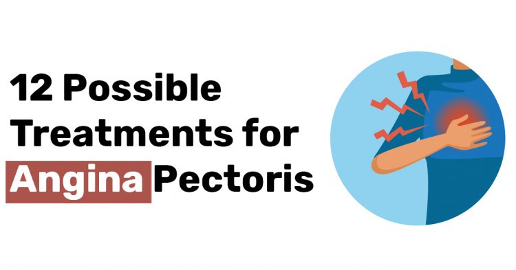 12 Possible Treatments for Angina Pectoris